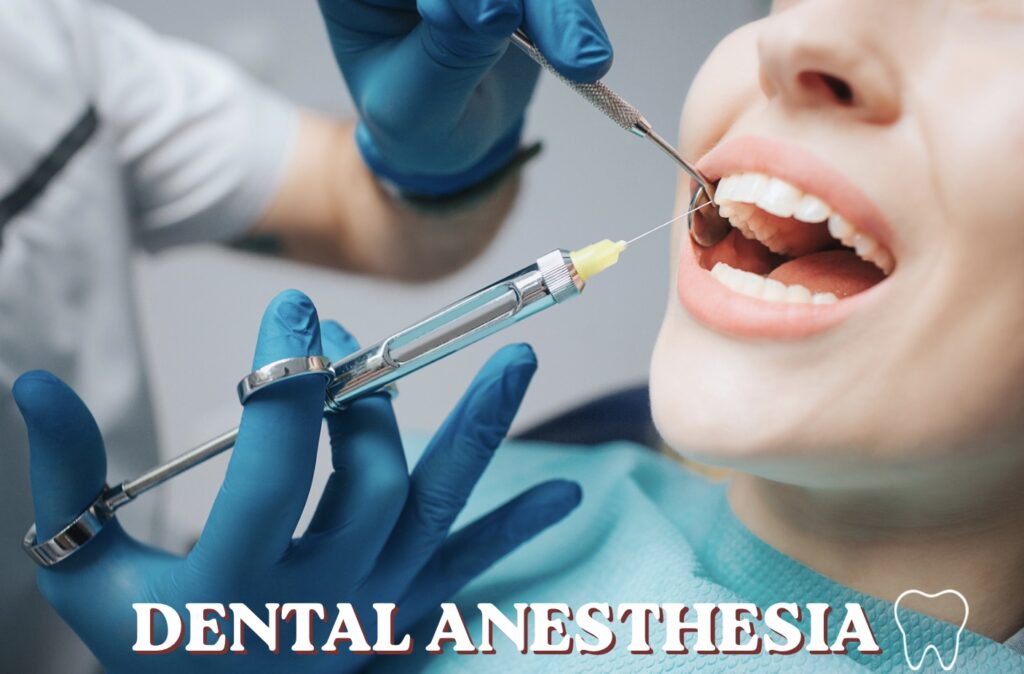 Dental anesthesia